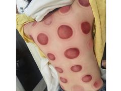 -通透堂中医·精准推拿(旗舰店)