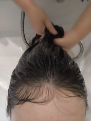 -菩叶脱发白发中心