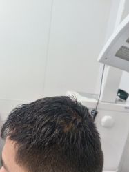 -雍禾植发
