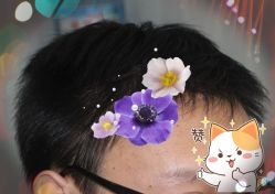 -大麦微针植发全国连锁