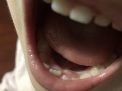 -美酷口腔牙齿矫正(江桥万达店)