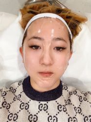 -八大处整形