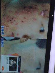 -痘博士天津·全国连锁祛痘机构