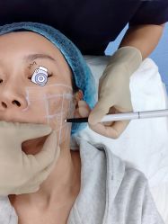 -海涛医疗美容·面部抗衰·注射美鼻