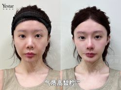 -Yestar艺星整形美容医院