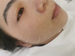 体验后-恒妍医美·韩国定制抗衰中心