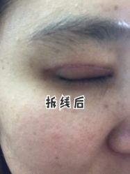 -云南吴氏嘉美医疗美容医院