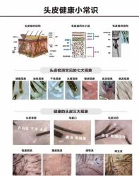 -章光101防脱养发荟