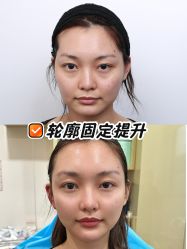 -上海时光整形外科医院