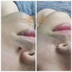 -美人痣全国连锁