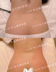 -Fundi张玉珊修身堂·indiba·BTL科技瘦身
