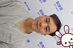 点击看大图 -大麦微针植发丨全国连锁