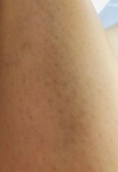 -深圳米兰柏羽医疗美容医院