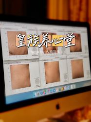 -皇族养心堂·净痘·修敏·御颜