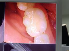 -土豆口腔(凤凰北总店)