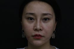 -深圳春天阳光医院·轮廓抗衰中心