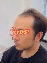 -唐风采假发补发定制