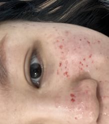 点击看大图 -丰联丽格医疗美容·联合丽格眼整形中心
