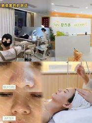 -塑青春&伊肤泉祛痘皮肤管理