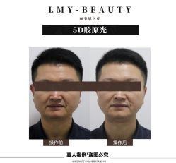 -丽美妍医疗美容·皮秒·立体分层抗衰