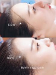 -babiline芭比莱恩半永久纹眉纹唇发际线
