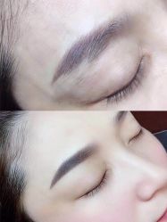 点击看大图 -郡艺医疗美容·微整·眼鼻吸脂