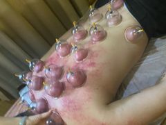 -韩蒸·东方艾·理疗艾灸养生馆