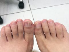 -新甲连锁灰指甲·甲沟炎·鸡眼(黑龙江路店)