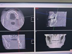 -土豆口腔(凤凰北总店)