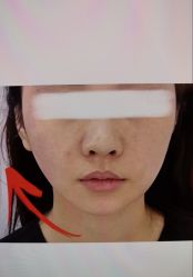 -Yestar 嘉兴艺星医疗美容医院