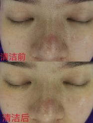 -蕾特恩专业祛痘·皮肤管理