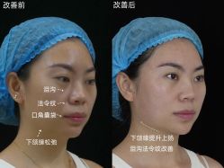 -Yestar重庆艺星医疗美容医院