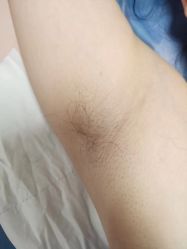 体验后-万州华美紫馨整形美容医院