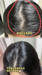 -TSO 慕尚·微潮派