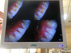-爱牙联合口腔(门诊报销 海云庵店)