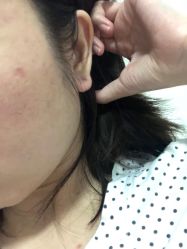 -花师傅专业手穿耳洞打耳洞穿孔