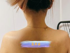 体验后-More摩尔医美の注射线雕光电中心