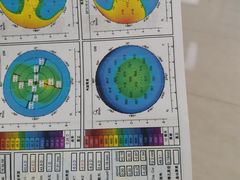 -美尔目眼科医院·近视手术·儿童近视(通州店)