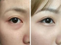 -紫洁俪方（北京）医疗美容