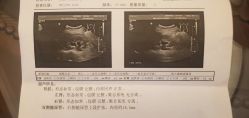 -上海美兰湖妇产科医院