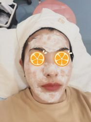 -郡艺医疗美容·微整·眼鼻吸脂