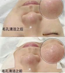 -海菲秀·飞顿牛奶光·LDM官方授权中心美轮美浣瓷感美肌