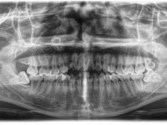 -爱贝口腔·牙周诊疗·种植修复中心