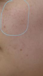 -南宁华美医疗美容医院