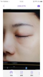 -丽美妍医疗美容·皮秒·立体分层抗衰