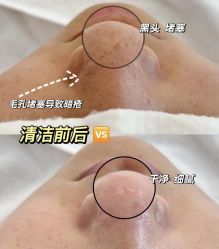 -SKIN79皮肤管理中心