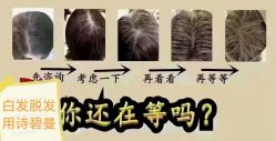 -诗碧曼养发