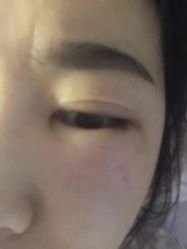 -新美荟医美·专注面部美学抗衰