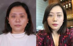 -加减美医美连锁品牌