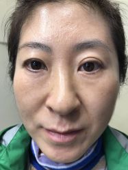 -美丽人生祛斑扁平疣汗管瘤中心